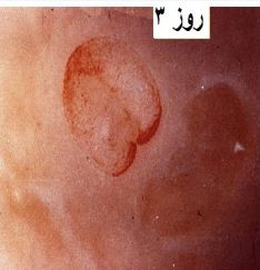 ماشین جوجه درآوری - جنین غاز روز سوم